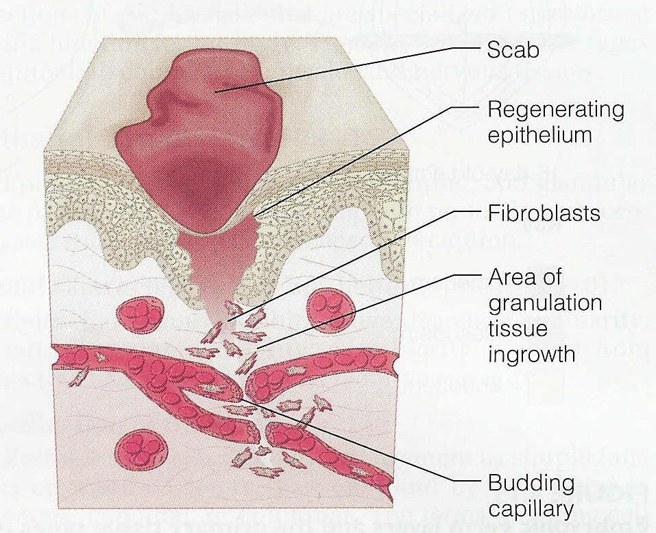 3. Angiogenesis 4.