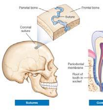 (Fibrous joints) Sutures Occur only between the flat bones of the skull.