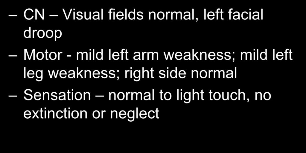Exam CN Visual fields normal, left facial droop Motor - mild left arm weakness; mild left
