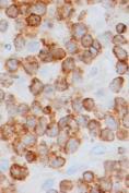 T-cell LINEAGE MARKERS NK/CYTOTOXIC CD16, CD56, CD57, TIA1,