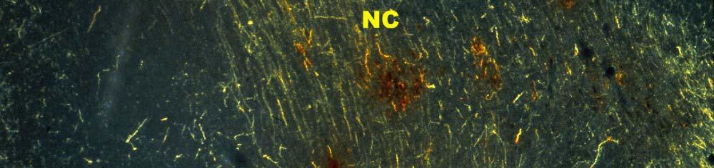 Neurons Localized to