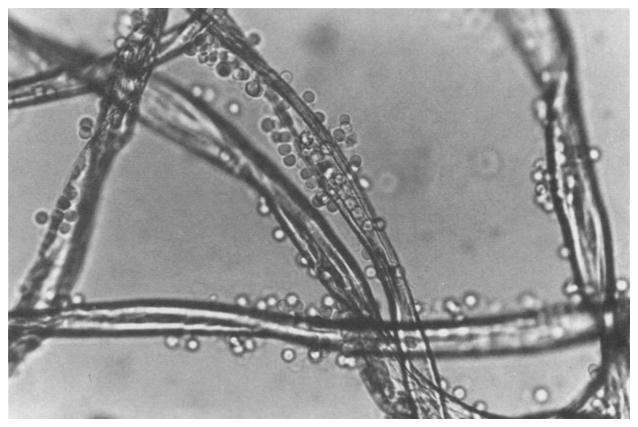 160 K. Tokiwa Fig. 2. Positive hemagglutination reaction of fibrils stained with 1:80 diluted human blood of group B in the modified mixed agglutination using anti-b serum and erythrocytes of group B.