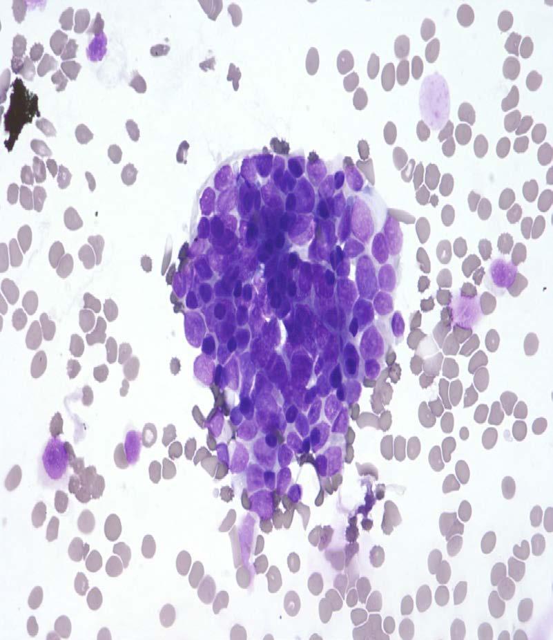 Atypical Imaging: well-defined, hypoechoic mass Cytology: few monomorphic cells Report: Adequacy: Evaluation limited by scant representative cells Interpretation: Few monomorphic nneoplastic cells
