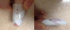 What if I need to change my splint? Below is a step by step guide to show you how to self-manage your splint.