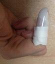 To remove your splint you need to remove the tape and splint safely without allowing the tip to be unsupported/drooping.
