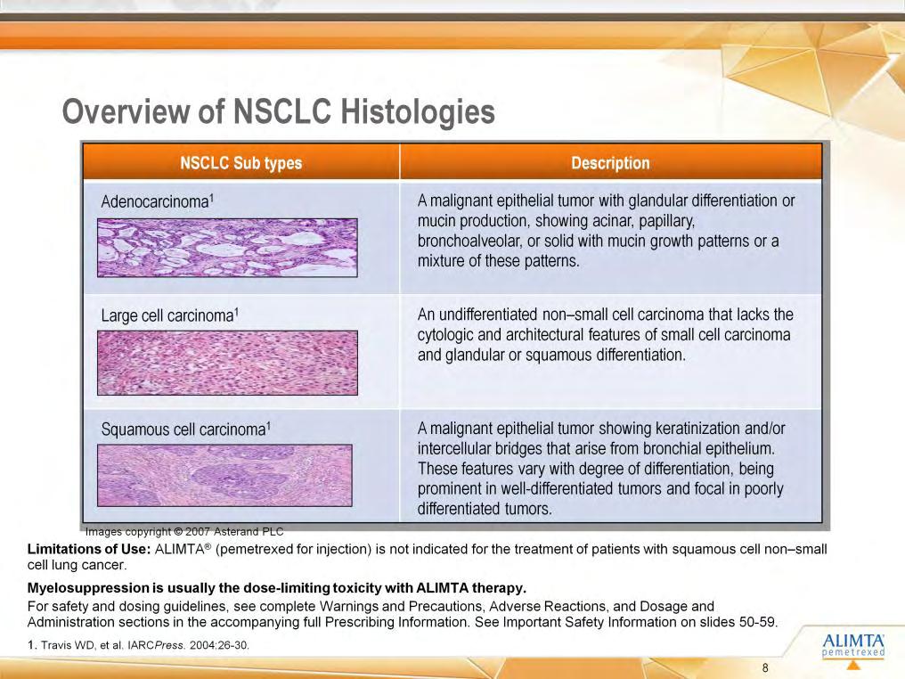 [Travis/p35/ col1/ 1] [Travis/p35/ p45/col1/ 1] [Travis/p35/ p27/col2/ 1/ col3/ 1] [Lilly deck MQ63933/slide 16 (REVISED] Adenocarcinoma is a malignant epithelial tumor with glandular differentiation