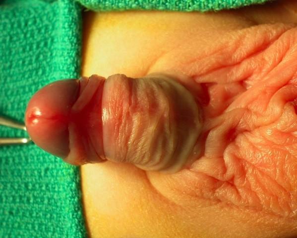 genitalia Male