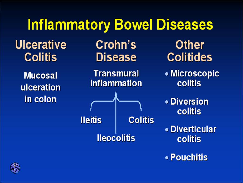 IBD Overview Chronic inflammatory condition of the GI tract affects up to 1.