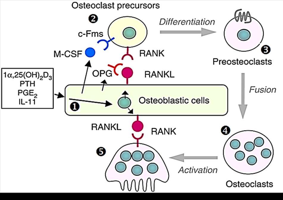 How osteoclast inhibited Many factors as 17-β oestradiol, Interlukin-4, Tumor growth factor-β, calcitonin all will stimulate osteoblastic cell to produce Osteoprotegerin (OPG), also known as
