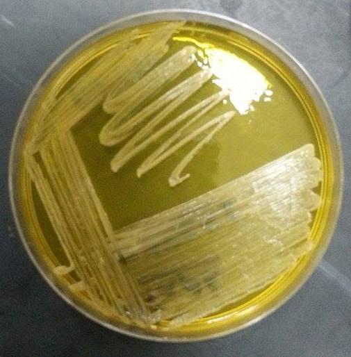 2- Staphylococcus albus: is negative for mannitol fermentation and gives white colonies on mannitol salt agar.