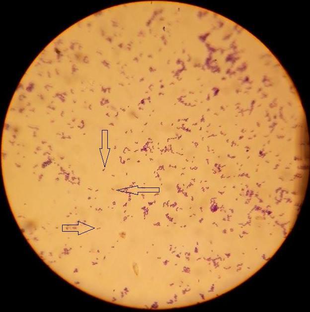 Streptococci Gram positive Streptococcus species are classified based on their hemolytic activity on blood agar into: 1- Alpha-hemolytic species cause partial hemolysis giving a greenish color on