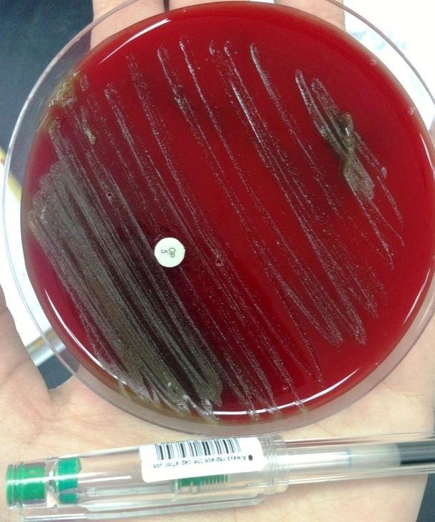 Blood agar is used. Alpha haemolytic Streptococci turn the colour of blood agar from red into greenish zone because of partial haemolytic activity.