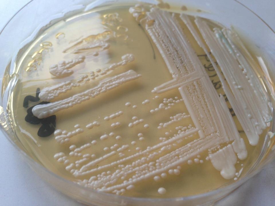 Candida Yeast is a big family which includes both non-pathogenic members such as Saccharomyces cerevisiae (baking yeast), and pathogenic members like Candida albicans, Candida tropicalis, and Candida