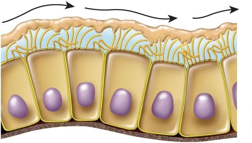 Cystic Fibrosis Cystic fibrosis hereditary disease in which cells make chloride pumps, but fail to install them in the plasma membrane Chloride pumps fail to create adequate saline layer on cell