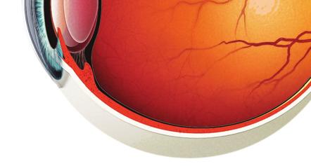 individual patient. What are the signs and symptoms of a cataract?