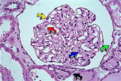 The Glomerulus and Bowman's Capsule Red = endothelial capillary cell; Yellow = epithelial cell of the visceral layer of Bowman's capsule; Green = simple squamous epithelial cell of the parietal layer