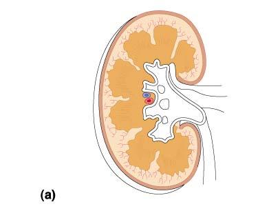 Structure of the Kidney Medulla } Papilla Pyramid Renal column Calyx Renal pelvis Cortex Ureter Figure 26.