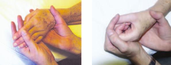 Be very careful as the wrist is another vulnerable joint that can become very loose or painful.