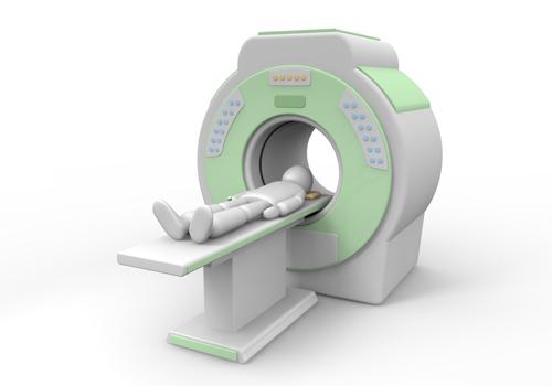 Imaging Recent onset seizures Focal neurological sign Magnetic resonance imaging (MRI)