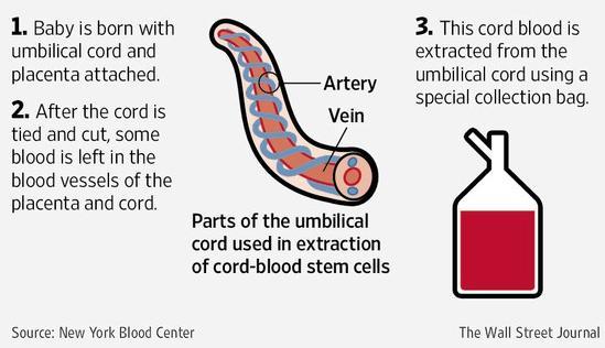 Umbilical Cord Blood Collection Procedure Placenta and umbilical cord is removed from delivery room Cleanse and puncture the umbilical