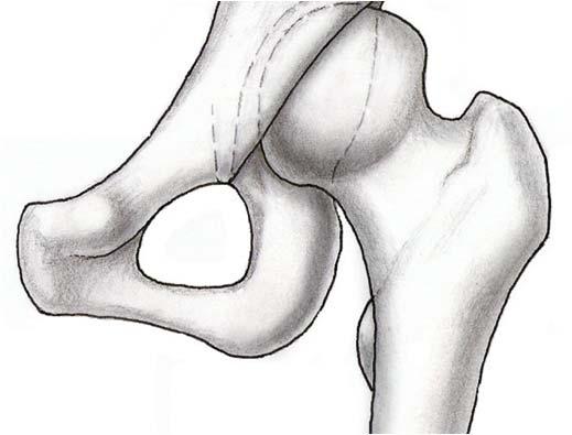 Osteotomies of the