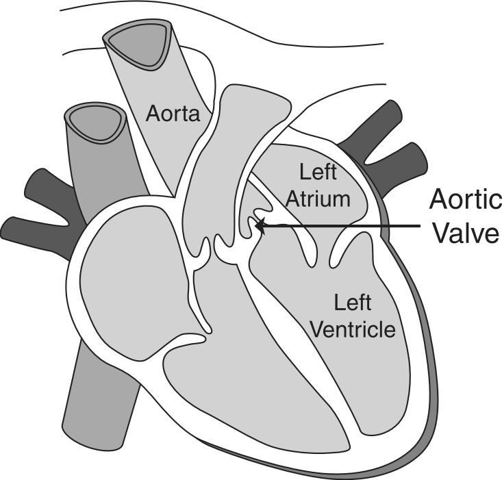 37. The diagram below shows a human heart. When contracted, the left ventricle pumps oxygenated blood to the body.