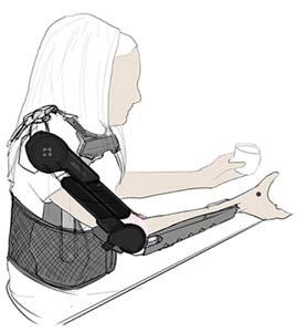 Active Powered Prosthesis (APEX) The Active Powered Prosthesis (APEX) (Abilitech Medical Inc.