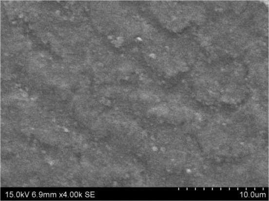 A Comparative Evaluation of the Effect of Remineralizing Agents on the 39 Surface Morphology and Microhardness of