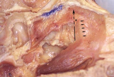 cavernous sinus, and rests against the lateral surface of the sphenoid bone.