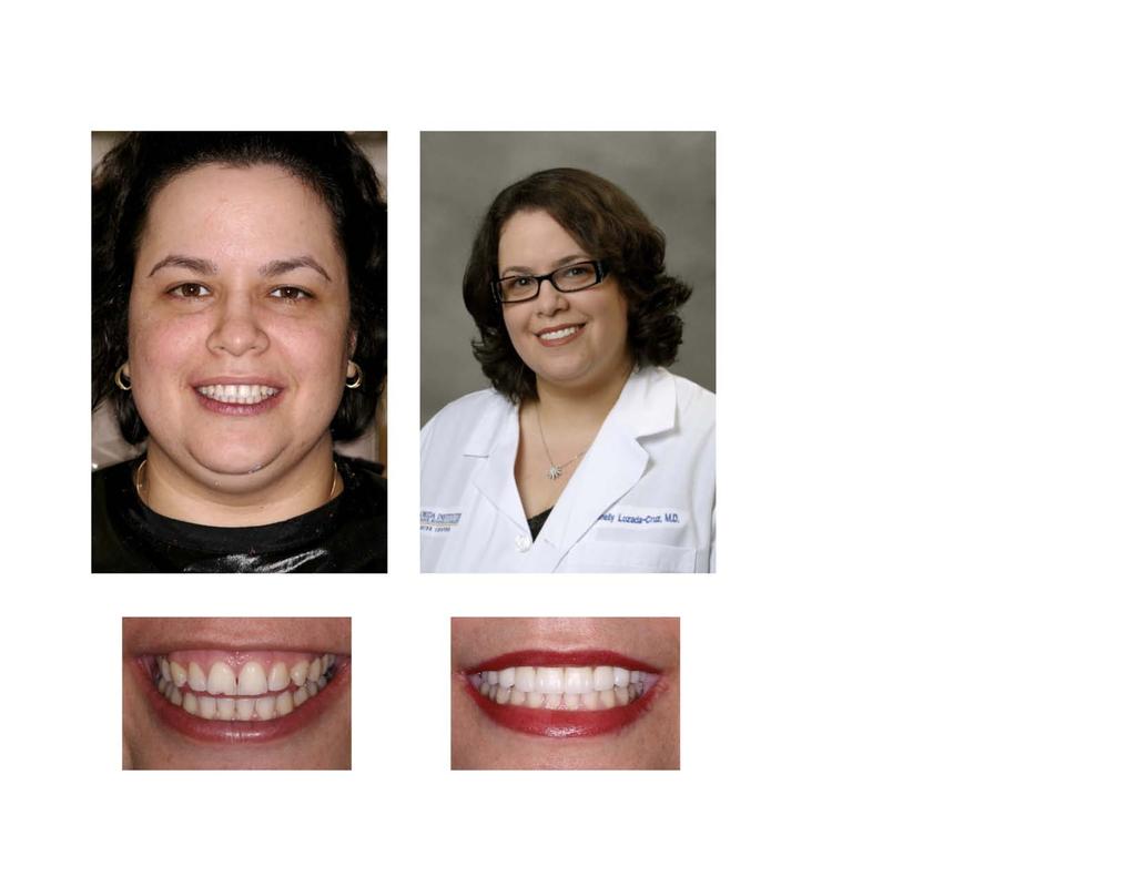 2 Dr. Brenelly is a Cancer Hematologist for a local hospital and she had recently found out about the dangers of having metal restorations in the mouth. During her research she came across Dr.