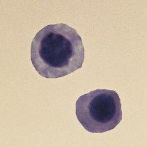Rubricyte The rubricyte is a round cell with a round, centrally located nucleus; it is smaller than the prorubricyte.