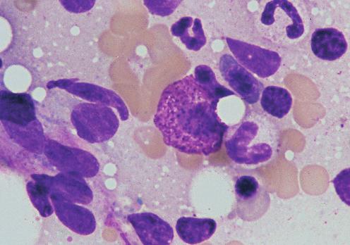 12 HEMATOPOIESIS Mast Cell Mast cells are found in very low numbers in bone marrow in most species but can be found in higher numbers in the bone marrow of rats.