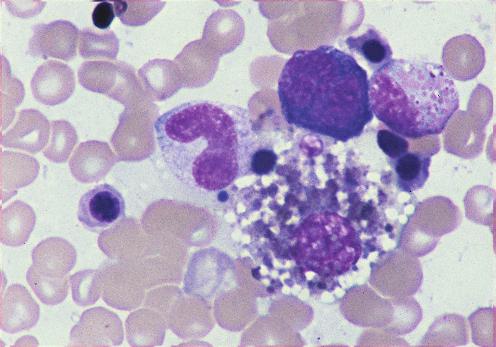H E M AT O P O I E S I S Macrophage. The large cell (right center) with abundant vacuolated cytoplasm and a round nucleus is a macrophage.