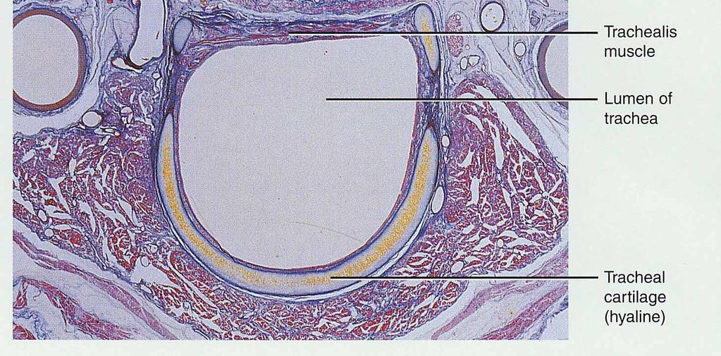 Histology of the Trachea Ciliated pseudostratified columnar epithelium