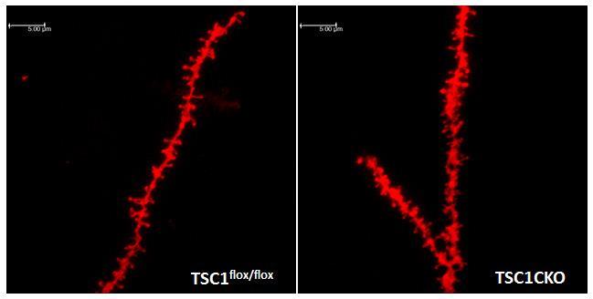 A C Figure 3. Neuronal activity in TSC1 mgfapcre CKO mice. (A) Representative traces showing miniature EPSC (mepsc) activity in control and Tsc1 CKO CA1 pyramidal neurons.