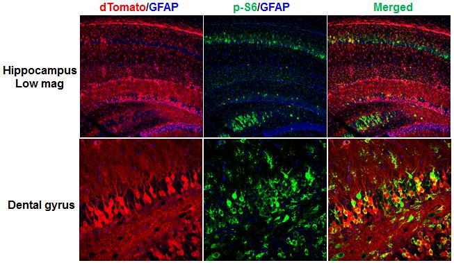 An alternative mechanism that may explain how epilepsy develops in our TSC1 mgfapcre CKO mice is altered intrinsic neuronal hyperexcitability, especially in those recombinant neurons deficient for