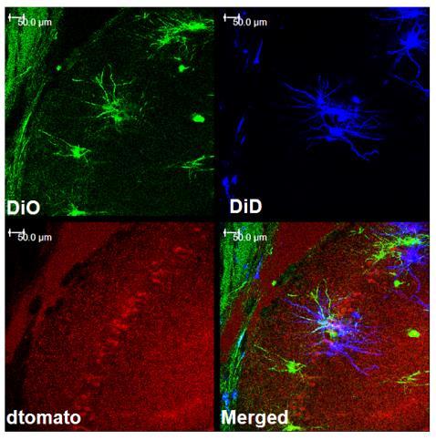 (A) low magnification images showing DiOlistically labeled dtomato+ and dtomato- neurons. DiO in green and DiD in blue.