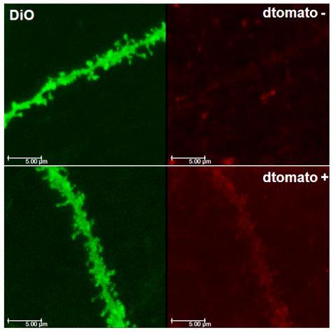 We will confirm this in the 3 rd year of the award. oth morphological and physiological properties of dtomato+ and dtomato- neurons will be compared between wt and TSC1 mgfapcre CKO mice.