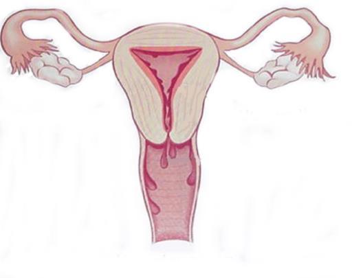 Menstruation is also referred to as a period.