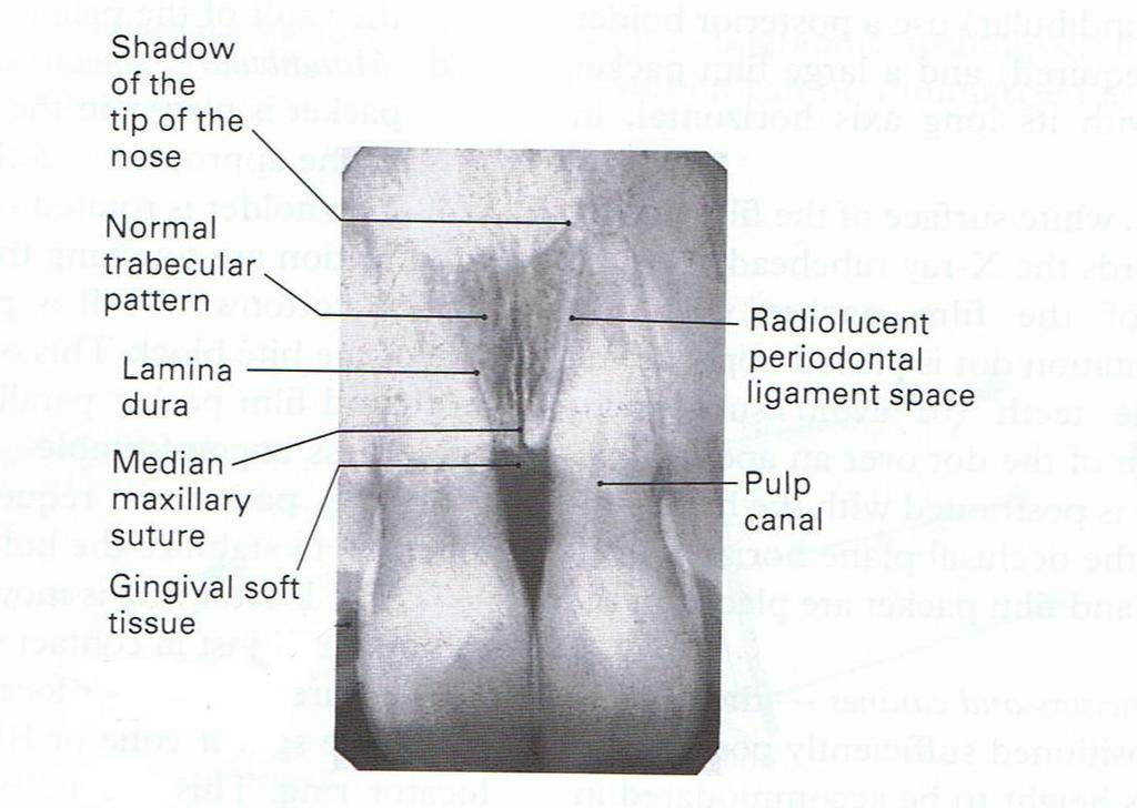 Radiographic Appearance