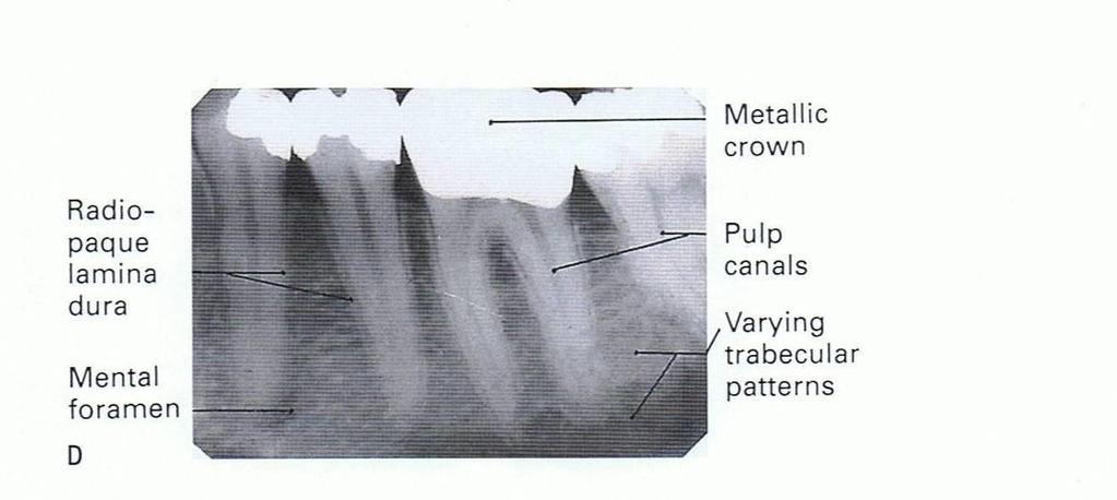 Radiographic appearance