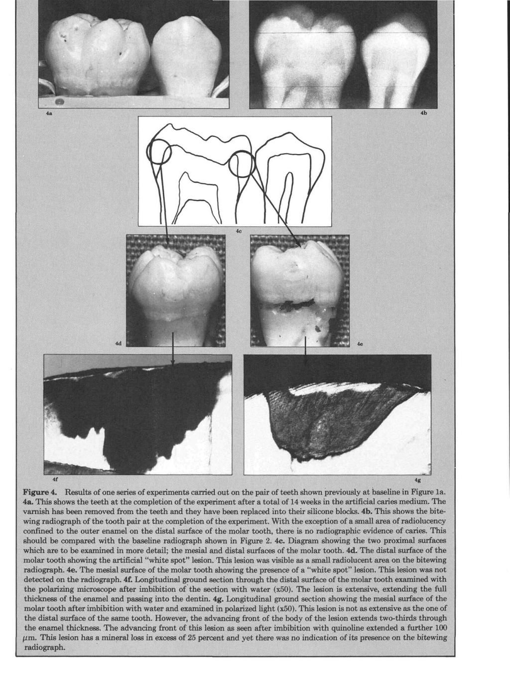 Figure 4. Results of one series of experiments carried out on the pair of teeth shown previously at baseline in Figure la. 4a.