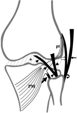 Anatomy of the PLC Posterolateral corner stabilizers are both sta/c and