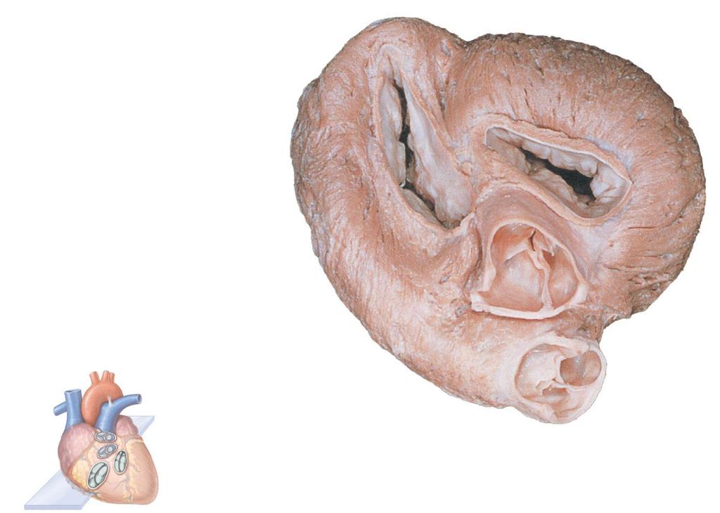 Myocardium Pulmonary valve Aortic valve Tricuspid Area of cutaway (right atrioventricular) Mitral valve