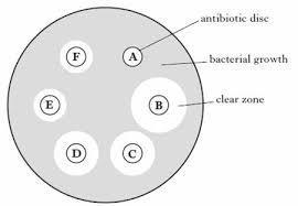 Required Practical: Preventing bacterial growth. To prevent bacteria growth we can use the following: Antibiotics for inside the body.
