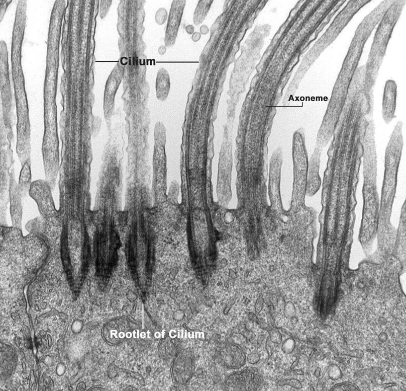microtubules and microfilaments Centrioles Act like fishing