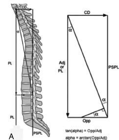 base of spine Ondra