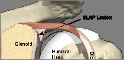 These muscles originate from your shoulder blade and their tendons form a hood covering the ball of your shoulder joint.