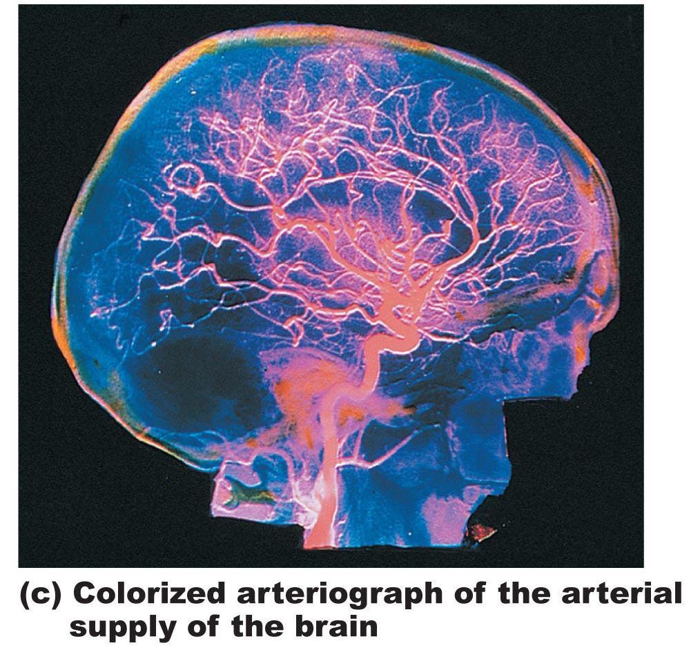 Arteries of the head, neck, and brain.