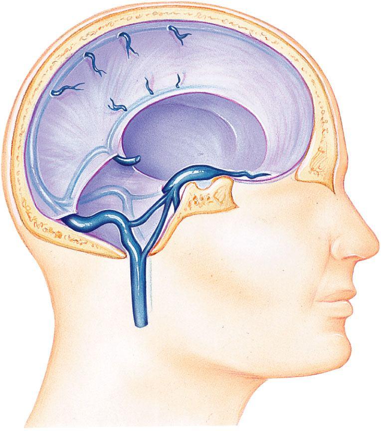 Veins of the Brain Superior sagittal sinus Falx cerebri Inferior sagittal sinus Straight sinus Cavernous